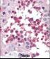 HSPA5 Antibody